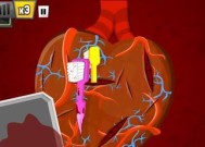 《疯狂外科医生3》第四大关五星通关攻略（用心小贴士）