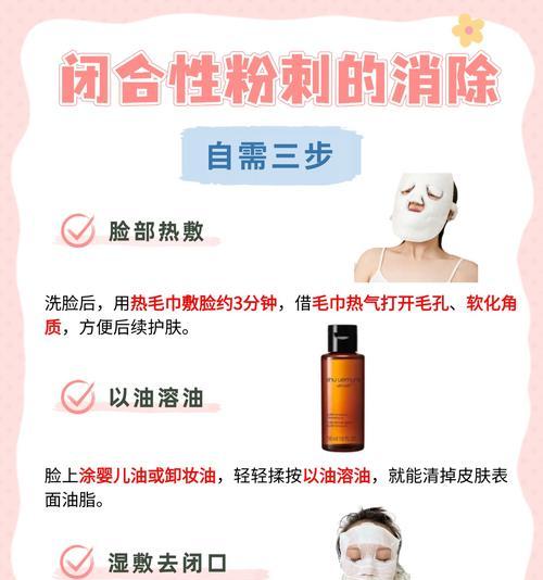 寻仙通天河怎么去粉刺？通天河粉刺清除方法是什么？  第1张